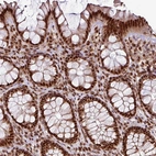 Immunohistochemical staining of human colon shows strong nuclear positivity in glandular cells.