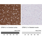 Anti-EPB41L1 Antibody