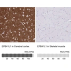 Anti-EPB41L1 Antibody