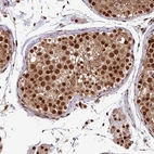 Immunohistochemical staining of human testis shows strong nuclear positivity in Leydig cells and cells in seminiferous ducts.