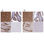Immunohistochemical staining of human cerebral cortex, fallopian tube, kidney and skeletal muscle using Anti-EPB41L1 antibody HPA054104 (A) shows similar protein distribution across tissues to independent antibody HPA056817 (B).