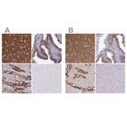 Immunohistochemical staining of human cerebral cortex, fallopian tube, kidney and skeletal muscle using Anti-EPB41L1 antibody HPA054104 (A) shows similar protein distribution across tissues to independent antibody HPA056817 (B).