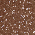 Immunohistochemical staining of human cerebral cortex shows strong cytoplasmic positivity in neuropil.