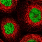 Immunofluorescent staining of human cell line A-431 shows localization to nucleoplasm.