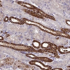 Immunohistochemical staining of human kidney shows strong membranous positivity in cells in distal tubules.