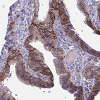 Immunohistochemical staining of human fallopian tube shows strong membranous positivity in glandular cells.