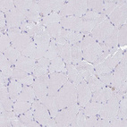 Anti-EPB41L1 Antibody