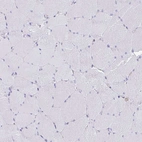 Immunohistochemical staining of human skeletal muscle shows no positivity in myocytes as expected.