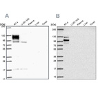 Western blot analysis using Anti-EPB41L1 antibody HPA054104 (A) shows similar pattern to independent antibody HPA056817 (B).
