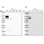 Western blot analysis using Anti-EPB41L1 antibody HPA054104 (A) shows similar pattern to independent antibody HPA056817 (B).