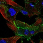 Immunofluorescent staining of human cell line A549 shows localization to plasma membrane.