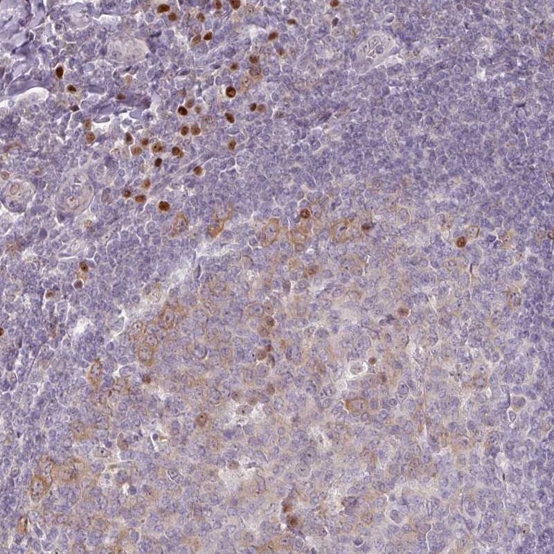 Anti-ZBTB6 Antibody