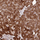 Anti-DLGAP4 Antibody