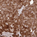 Anti-DLGAP4 Antibody