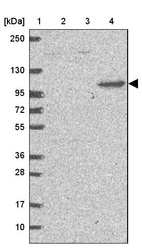 Lane 1: Marker [kDa] 250, 130, 95, 72, 55, 36, 28, 17, 10_br/_Lane 2: Human cell line RT-4_br/_Lane 3: Human cell line U-251MG sp_br/_Lane 4: Human plasma (IgG/HSA depleted)