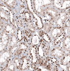 Anti-ZNF266 Antibody