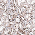 Immunohistochemical staining of human kidney shows moderate nuclear positivity in cells in tubules.
