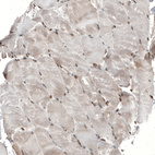 Immunohistochemical staining of human skeletal muscle shows moderate nuclear positivity in myocytes.