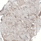 Immunohistochemical staining of human skeletal muscle shows moderate nuclear positivity in myocytes.