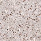 Immunohistochemical staining of human cerebral cortex shows moderate nuclear positivity in neurons.