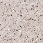 Immunohistochemical staining of human cerebral cortex shows moderate nuclear positivity in neurons.