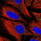 Immunofluorescent staining of human cell line HeLa shows localization to rods & rings & vesicles.