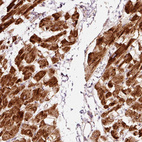 Anti-TOB2 Antibody