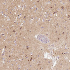 Immunohistochemical staining of human cerebral cortex shows moderate cytoplasmic positivity in neuropil and neurons.