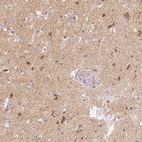 Immunohistochemical staining of human cerebral cortex shows moderate cytoplasmic positivity in neuropil and neurons.