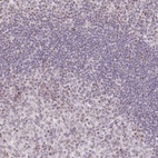 Anti-TLE3 Antibody