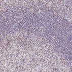 Immunohistochemical staining of human tonsil shows weak to moderate nuclear positivity in lymphocytes.