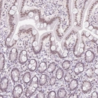 Immunohistochemical staining of human duodenum shows moderate nuclear positivity in glandular cells.
