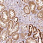 Immunohistochemical staining of human kidney shows moderate cytoplasmic-membranous positivity in cells in tubules.