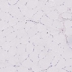 Immunohistochemical staining of human skeletal muscle shows no nuclear positivity in striated muscle fibers as expected.