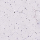 Immunohistochemical staining of human skeletal muscle shows no nuclear positivity in striated muscle fibers as expected.