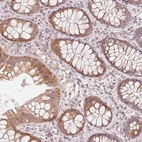 Immunohistochemical staining of human colon shows moderate cytoplasmic-membranous positivity in glandular cells.