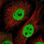 Immunofluorescent staining of human cell line HeLa shows localization to nucleoplasm.