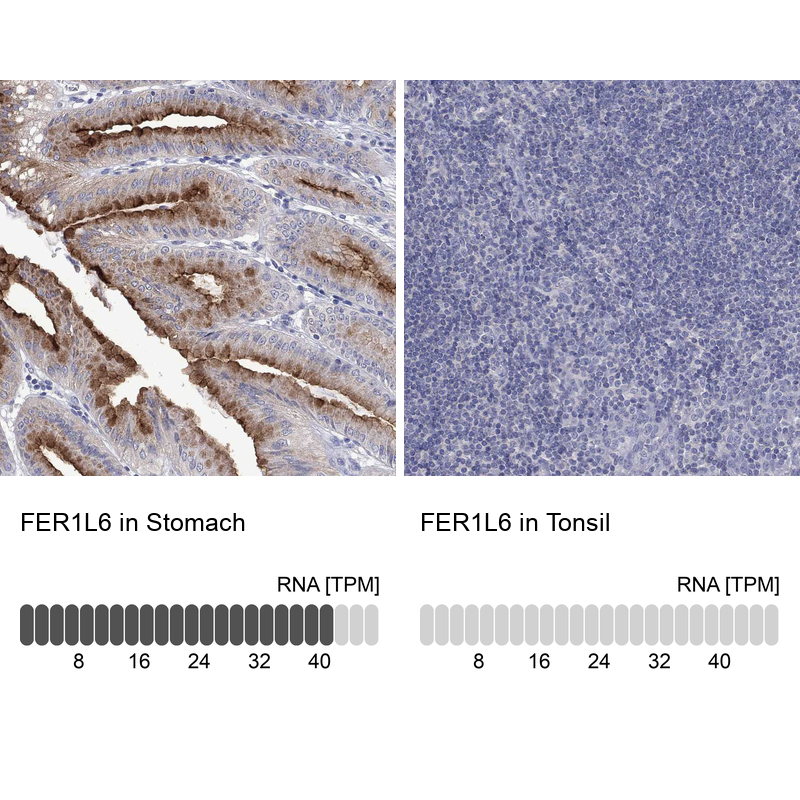Anti-FER1L6 Antibody