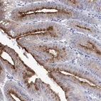 Immunohistochemical staining of human stomach shows strong membranous positivity in glandular cells.