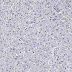 Immunohistochemical staining of human liver shows no positivity in hepatocytes as expected.