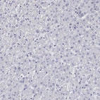 Immunohistochemical staining of human liver shows no positivity in hepatocytes as expected.