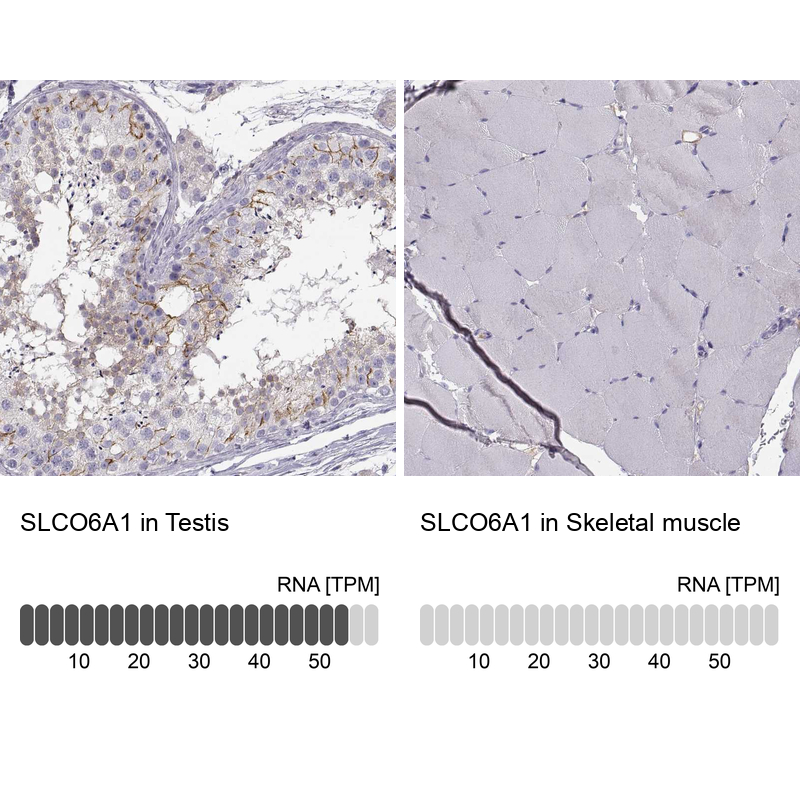Anti-SLCO6A1 Antibody
