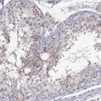 Immunohistochemical staining of human testis shows strong membranous positivity in cells in seminiferous ducts.