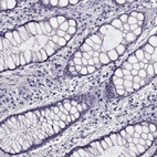Immunohistochemical staining of human rectum shows no positivity in glandular cells as expected.