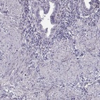 Anti-SLCO6A1 Antibody
