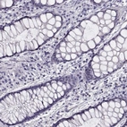 Immunohistochemical staining of human rectum shows no positivity in glandular cells as expected.