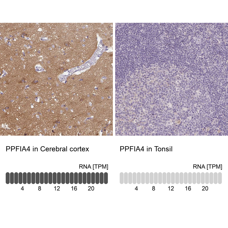 Anti-PPFIA4 Antibody