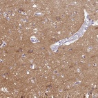 Immunohistochemical staining of human cerebral cortex shows high expression.