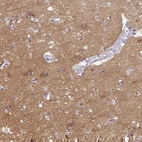 Immunohistochemical staining of human cerebral cortex shows high expression.