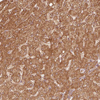 Anti-MRPL16 Antibody